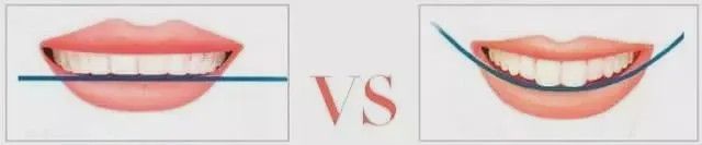 如何笑起来更好看_微笑训练教程_女明星大笑好看